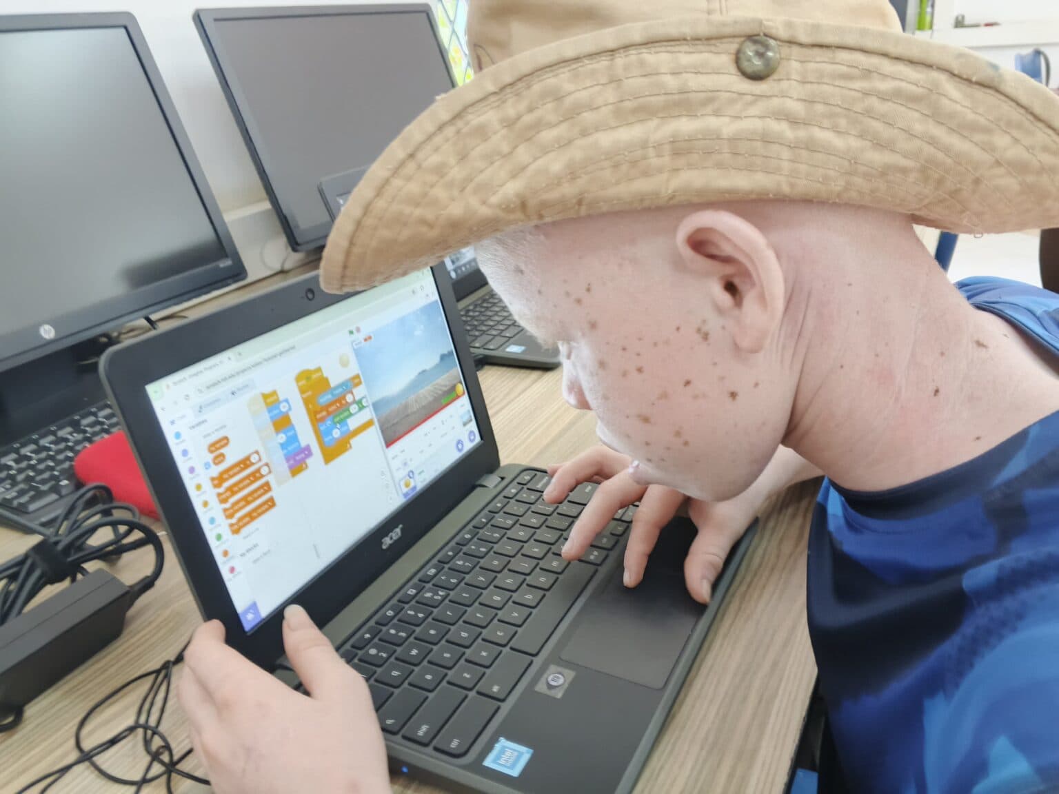 A young person with albinism, wearing a wide-brimmed hat and a blue shirt, is intently working on a laptop at a desk. The laptop screen displays a Scratch programming interface with colorful code blocks and a beach scene in the preview window.